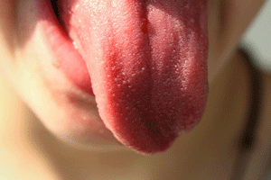 舌ピアスの腫れる期間